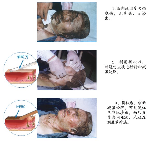 bte·365(中国)体育在线官网